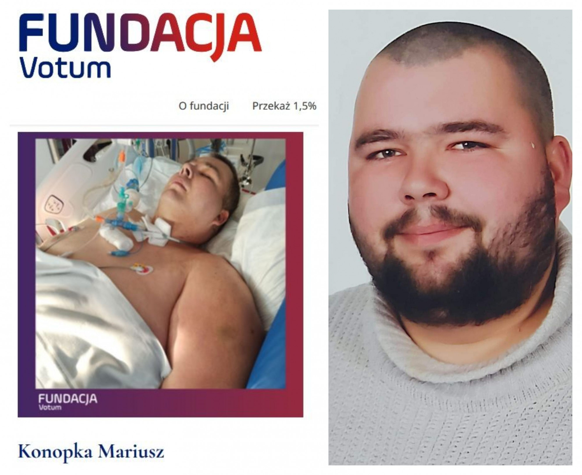 Zestawione dwa zdjęcia Mariusza Konopki - jedno z dowodu osobistego, drugie z pobytu w szpitalu.